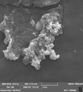 SEM image of nano Ni(OH)2powder